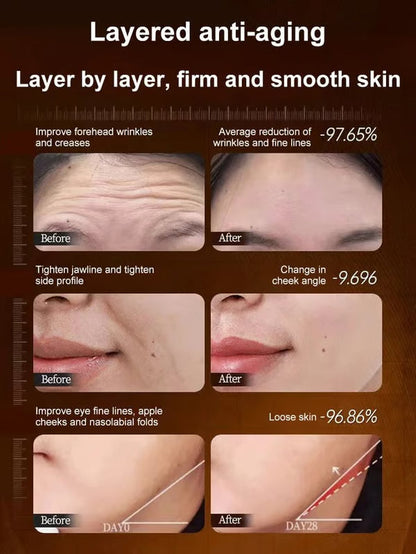 【One touch to remove wrinkles】Micro-molecular collagen anti-wrinkle lotion