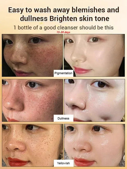 Upgraded anti-freckle essence oil