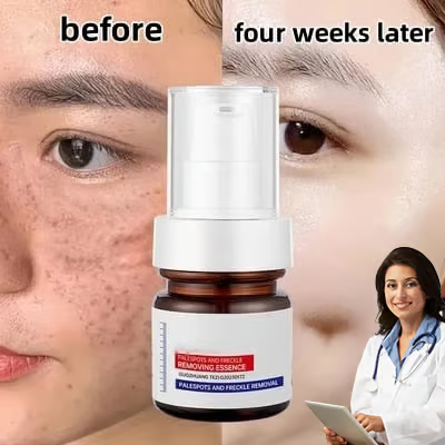 🔥Vitamin C Whitening Freckles Face Cream Remove Melasma Dark Spots Lighten Melanin