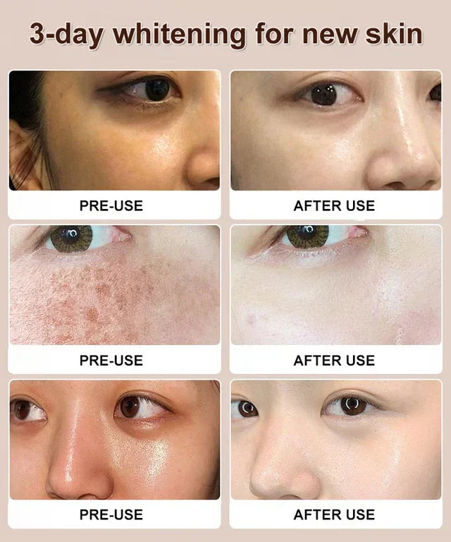 NIACINAMIDE PURIFYING WHITENING CLEANSER 🔥(BUY 3 GET 3 FREE)🔥