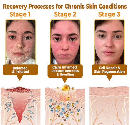 ❯  The "Forbidden" Natural Discovery That Erases Years of Skin Damage & Ends The Daily Battle With Psoriasis, Wrinkles & Chronic Skin Conditions