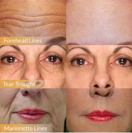 🔥 Buy 1 Get 1 Free🔥POLYPEPTIDE FIRMING FULL FACE CREAM-CHANGE FOR BEAUTIFUL SKIN WITHIN 2 WEEKS