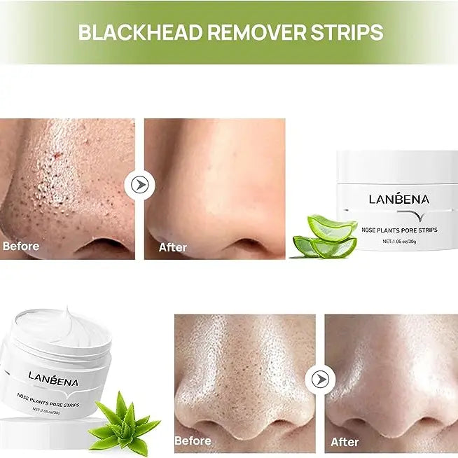 🔥 Blackhead Remover Peel Off Mask (🔥BUY 2 GET EXTRA 10% OFF🔥)